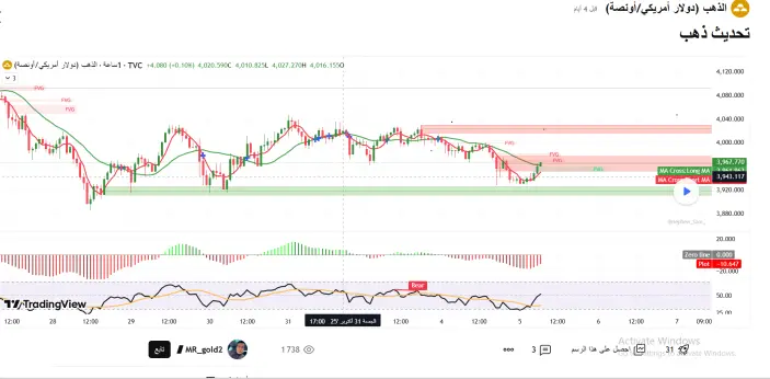محلل ذهب على تريدينج فيو